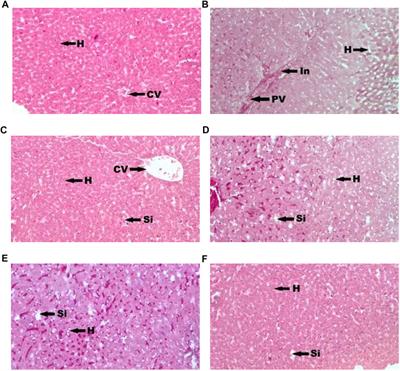 Antidiabetic and Antihyperlipidemic Effects of Methanolic Extract of Leaves of Spondias mombin in Streptozotocin-Induced Diabetic Rats